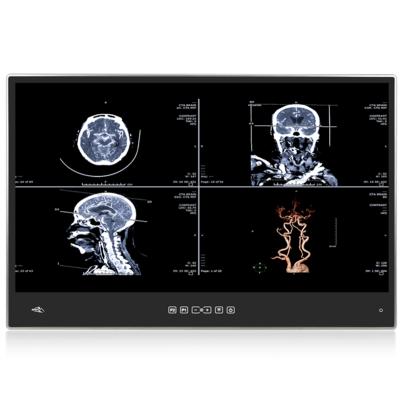 22吋醫療觸控電腦 POCi-W22C-ULT5